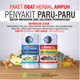 Illustration for article titled Obat Herbal Penyakit Paru Paru Kronisem/em